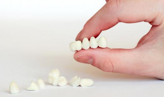 Протезирование зубов безметалловой керамикой